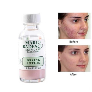 (29ml) Dung Dịch Chấm Mụn Mario Badescu Drying Lotion
