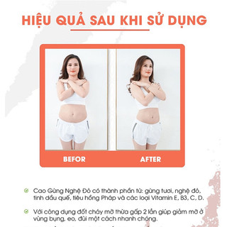 Cao Gừng Nghệ Đỏ Tan Mỡ Bụng 180ml