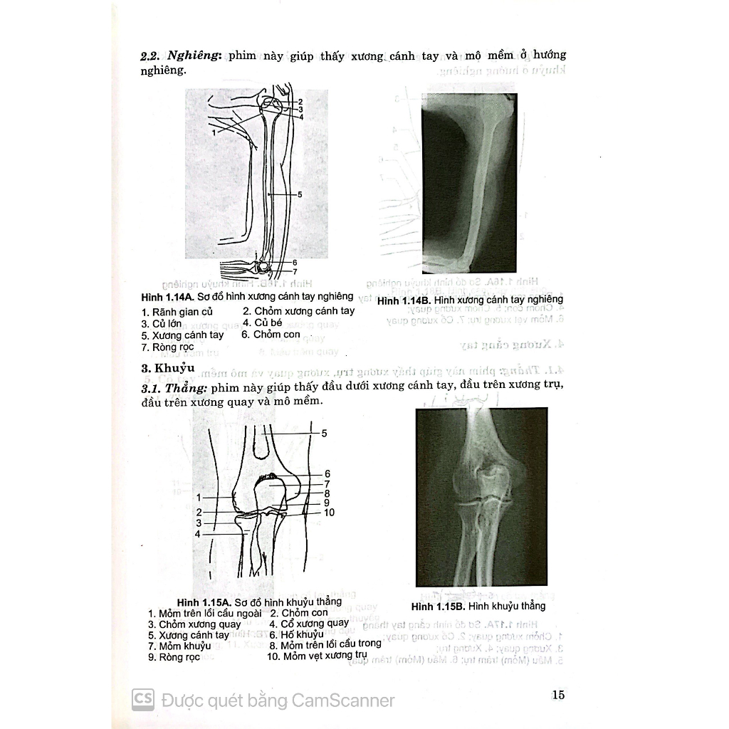 Benito - Sách - Giải phẫu X-quang