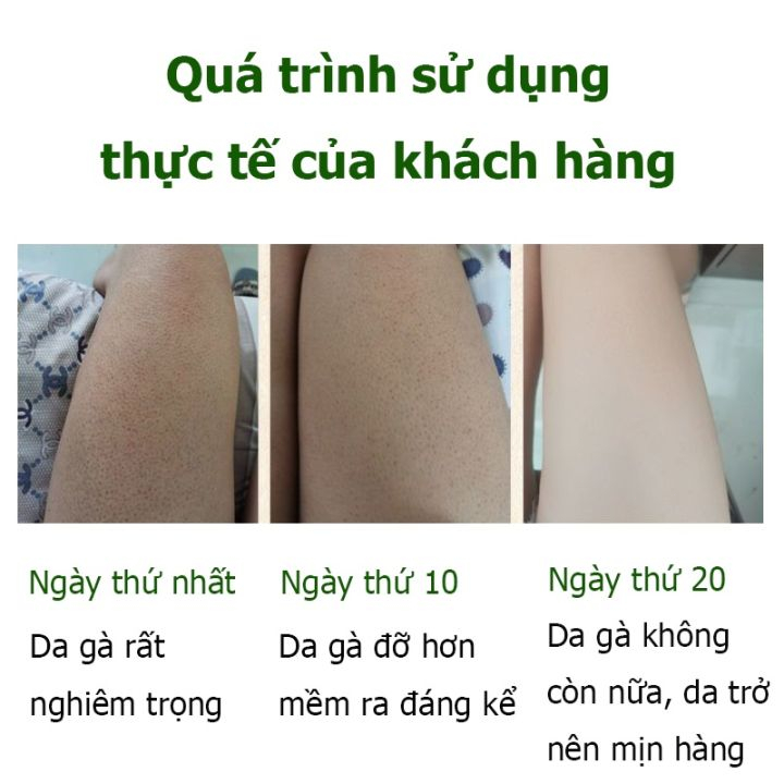 tẩy tế bào chết mặt kem tẩy tế bào chết kem tẩy tế bào chết 250g thu nhỏ lỗ chân lông làm trắng Dưỡng ẩm cho da