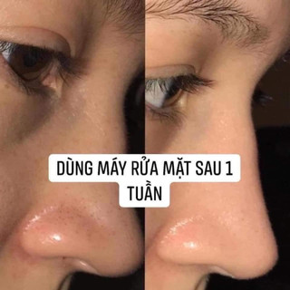 Máy Rửa Mặt Con Cá Wellderma Phiên Bản Mới