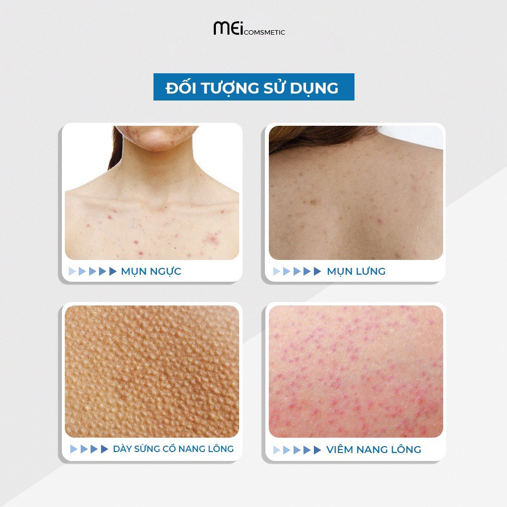 Combo Freeskin-  Bộ Sản Phẩm Viêm Nang Lông, Mụn Trứng Cá, Mụn Mặt Và Cơ Thể