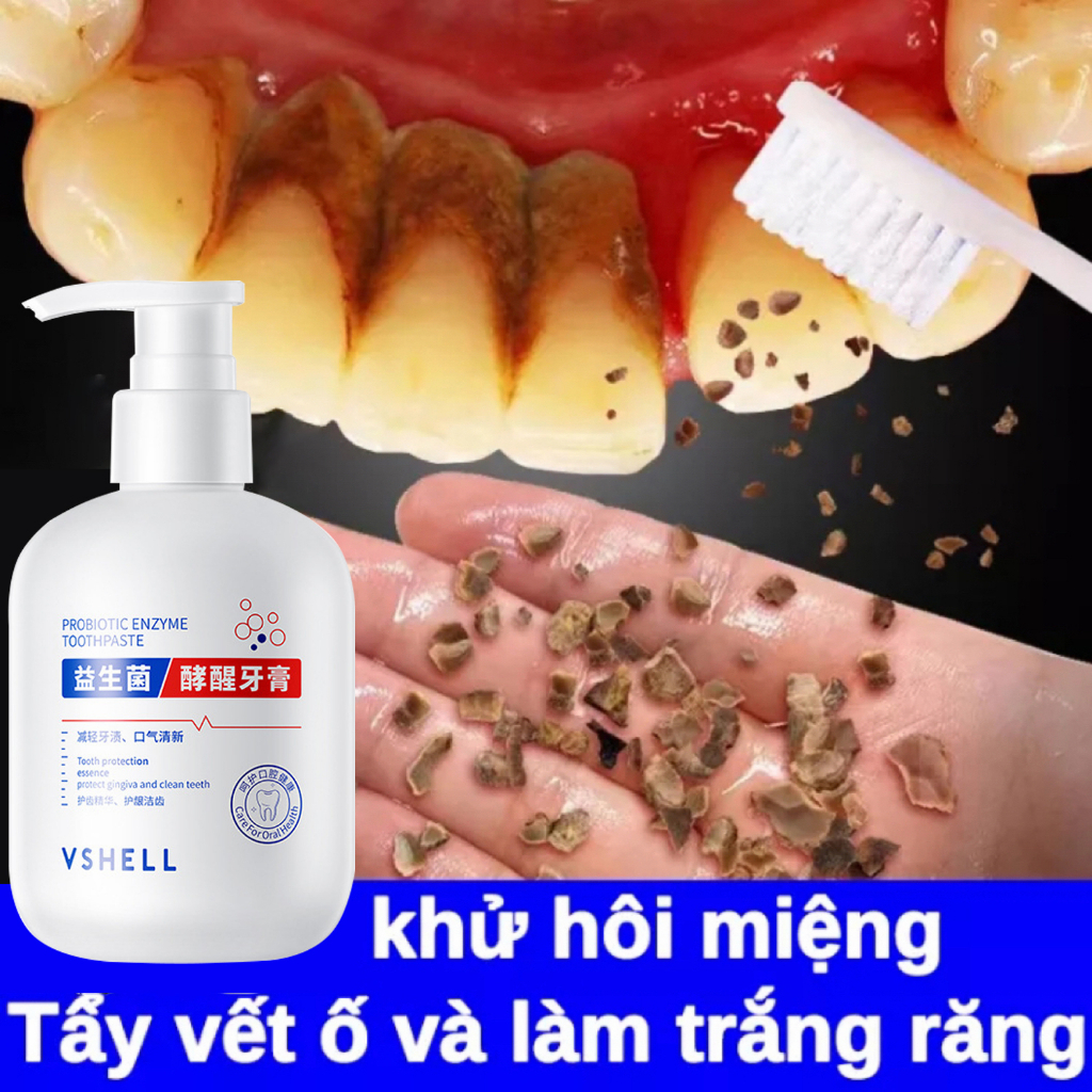 Kem đánh răng Làm trắng răng Giảm ố vàng răng, sâu răng 250g tẩy trắng răng Giữ Hơi Thở Thơm Mát kem đánh trắng