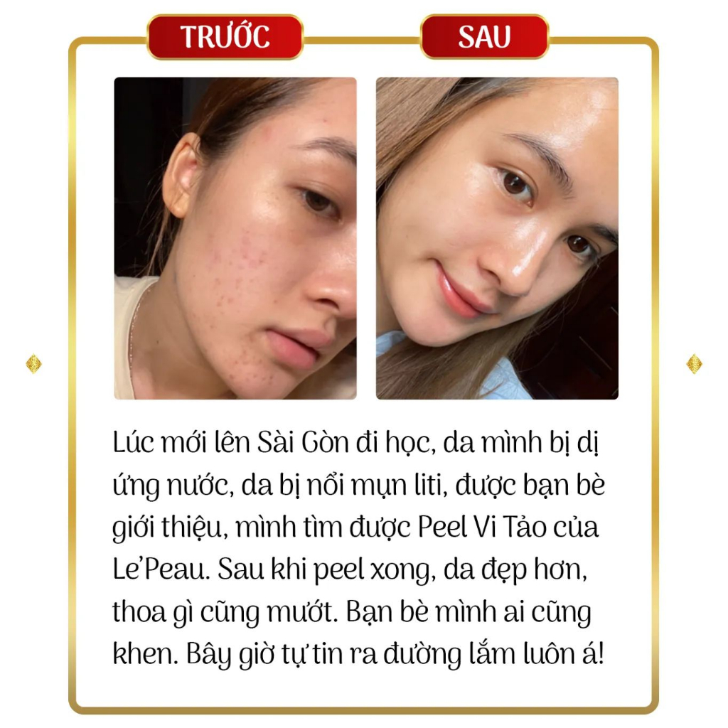 [Lepeau] Peel da vi tảo retinol Hoàng Thiên Sâm 10ml