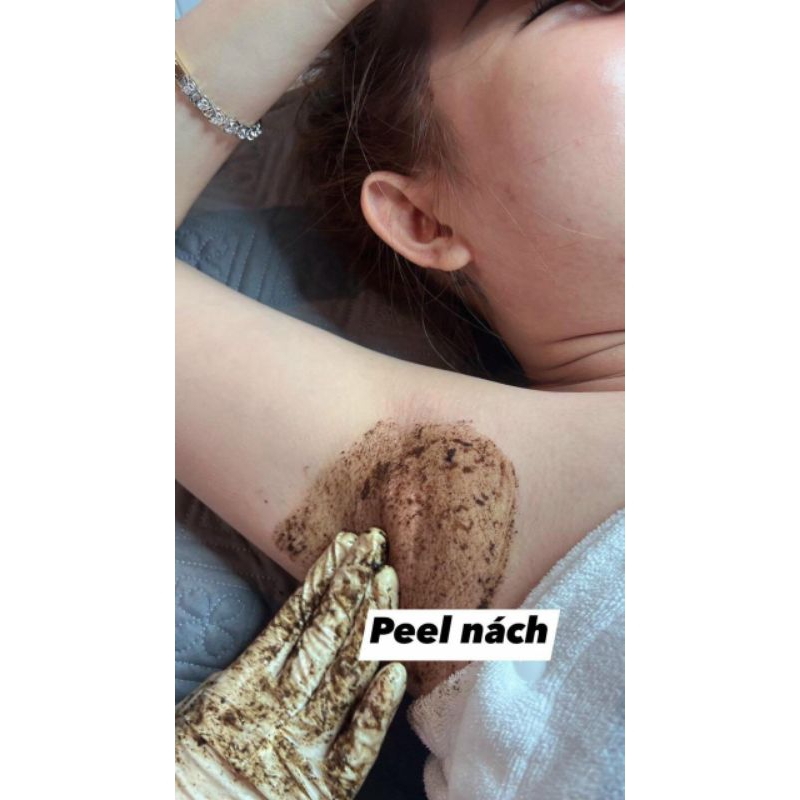 Vi tảo dành cho mặt, nách, mông, lưng bị mụn thâm handmade.