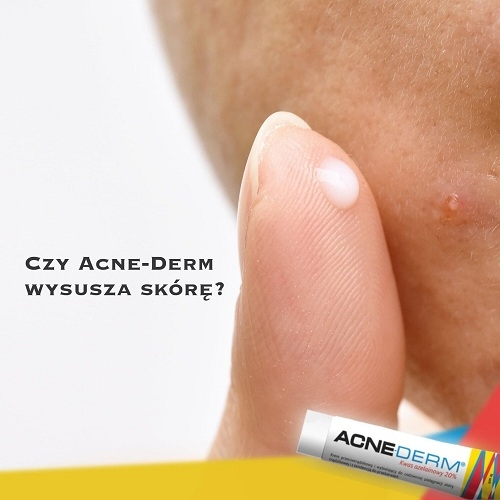 Kem ACNEDERM Giảm Mụn, Mờ Thâm, Làm Trắng Da Acne-Derm Kwas Azelainowy 20%