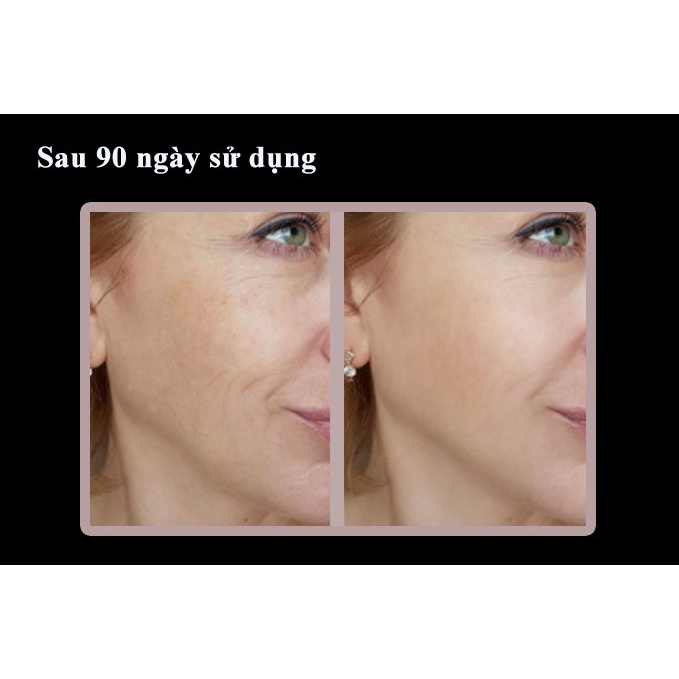 Máy Nâng Cơ Mặt Xóa Nọng Cằm H1031, 4 Chức Năng Hoạt Động, Trẻ Hóa Và Tạo Hình Vline Cho Khuôn Mặt