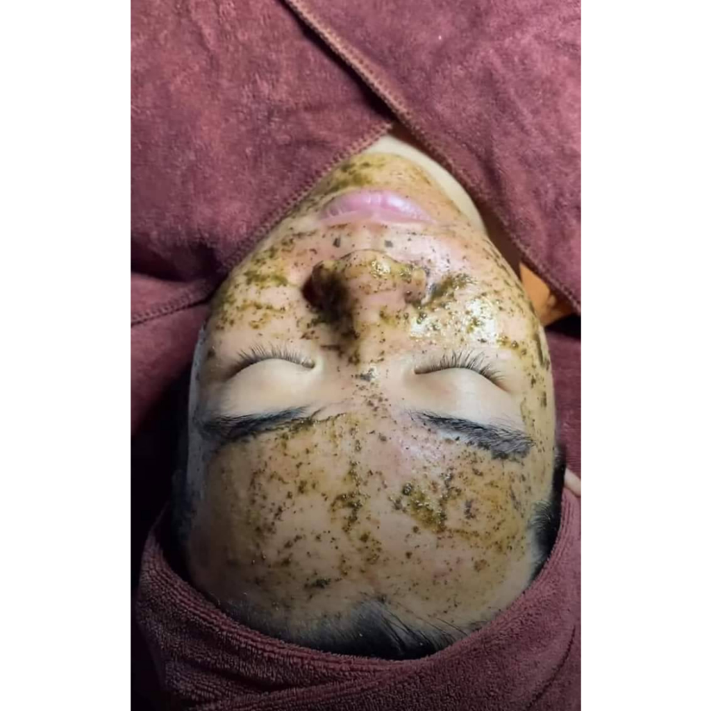 Peel Da Vi Tảo - Tái Sinh Lan Da Tươi Trẻ Căng Min - Xóa Mun Mơ Thâm Nám - Cải Thiện Sắc Tô Da