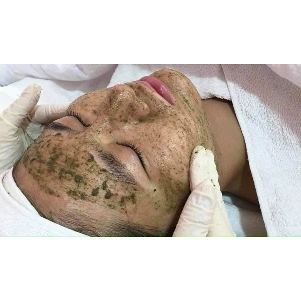 Peel Da Vi Tảo - Tái Sinh Lan Da Tươi Trẻ Căng Min - Xóa Mun Mơ Thâm Nám - Cải Thiện Sắc Tô Da