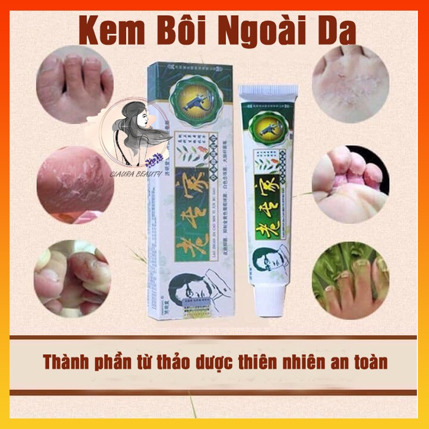 [Xanh Lá] Kem Bôi Ngoài Da Chống Nứt Nẻ Bong Tróc Khô Da