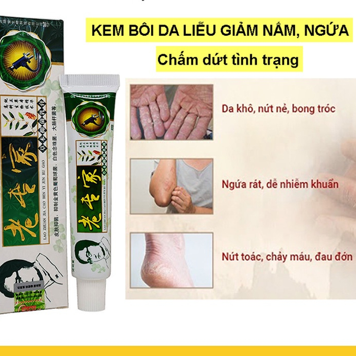 [Xanh Lá] Kem Bôi Ngoài Da Chống Nứt Nẻ Bong Tróc Khô Da
