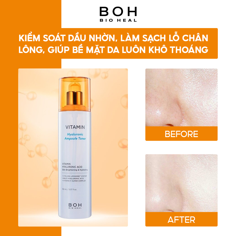 Nước Cân Bằng Cấp Ẩm Bioheal BOH Vitamin Hyaluronic Ampoule Toner 150ml