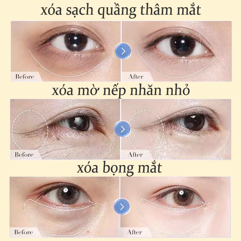 kem dưỡng mắt kem chống lão hóa vùng mắt kem trị thâm mắt 60g Giảm quầng thâm xóa nếp nhăn và bọng mắt chăm sóc mắt