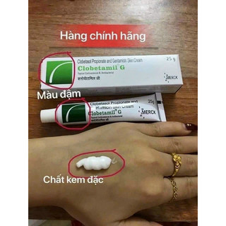 Tuýp nám Clobetamil G ngừa nám tàn nhang 25g