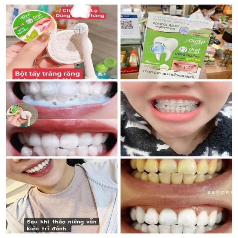 Kem Tẩy Trắng Răng Derrich Oral Herbal Thái Lan Giúp Loại Bỏ Mảng Bám, Dành Cho Răng Niền Và Răng Thường
