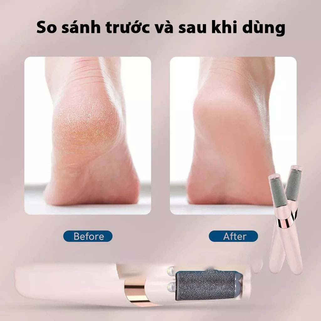 Máy chà gót chân chạy điện tự động các vết chai kèm chân sạc USB nhỏ gọn tiện dụng