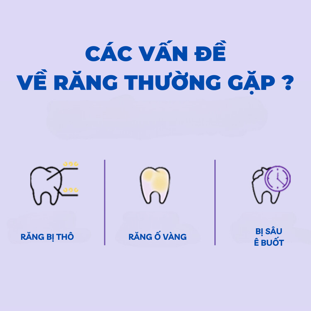 Kem Đánh Răng Trắng Răng v34, 28 ngày trắng răng tại nhà, thành phần tự nhiên không gây ê buốt, an toàn và nhẹ nhàng