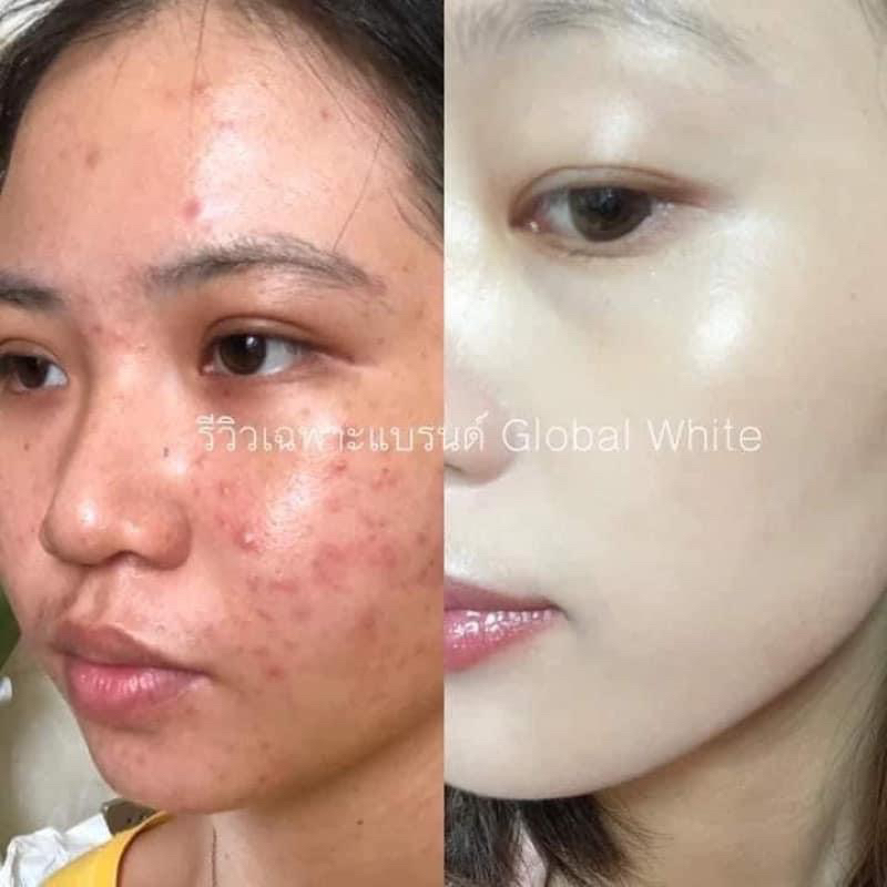 Collagen cà chua nguyên chất trắng da & giảm mụn 50g