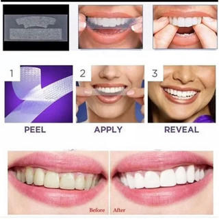 Miếng dán tẩy trắng răng OralB 3D White Whitestrips (Hộp 28 miếng-14 cặp)