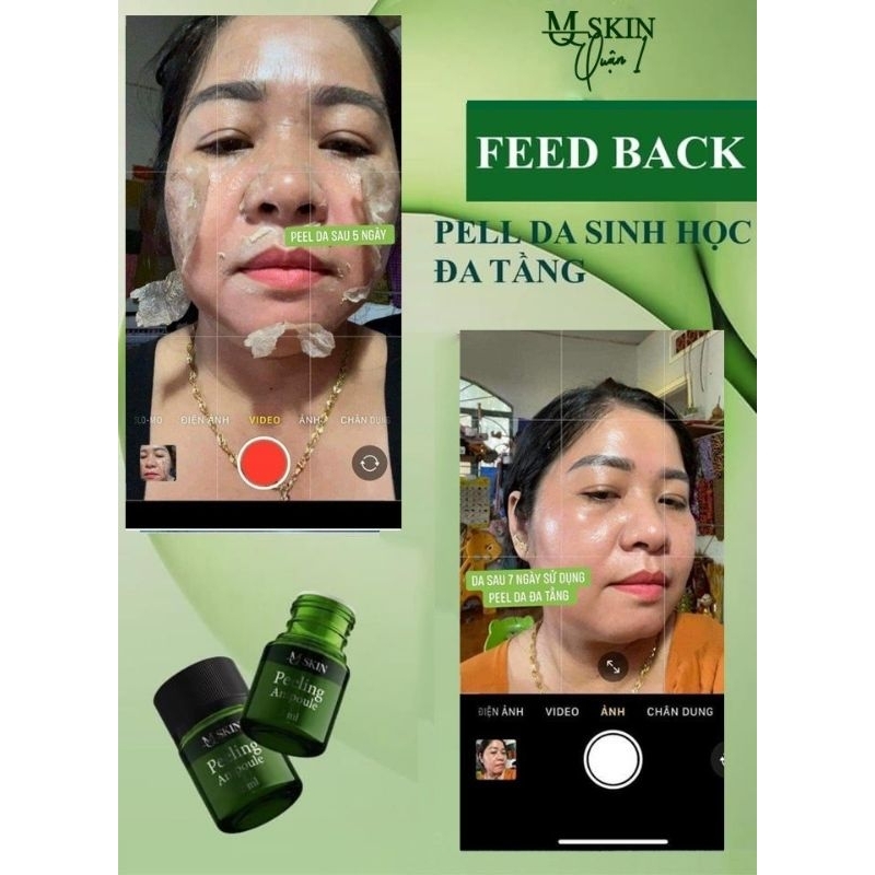 PEEL DA ĐA TẦNG SINH HỌC