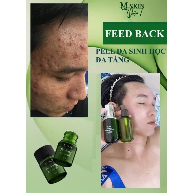 PEEL DA ĐA TẦNG SINH HỌC