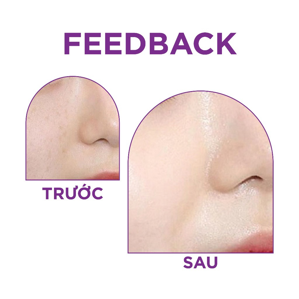 Serum HA B5 ABO, Giúp cấp ẩm, dưỡng da và chống lão hoá 30ml - MILAB