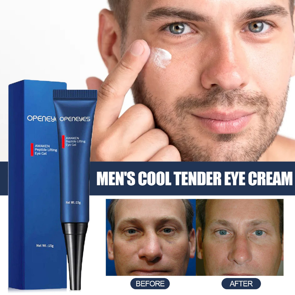 OpenEyes Kem xóa bọng mắt nhập khẩu chính hãng 15gr