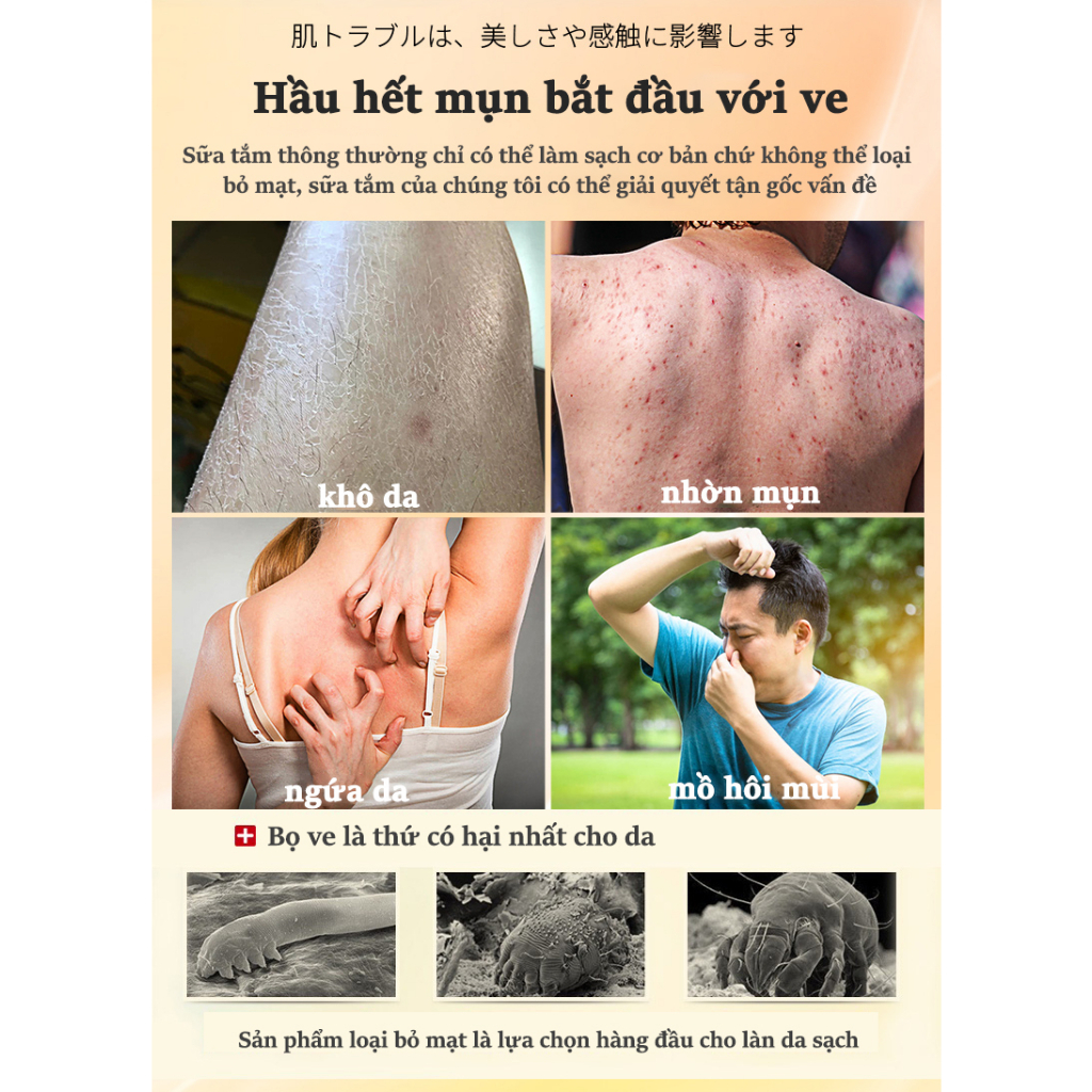 Sữa  tắm trắng da sữa tắm mụn lưng sữa tắm viêm nang lông 400ML chiết xuất 100% suối lưu huỳnh tự nhiên.