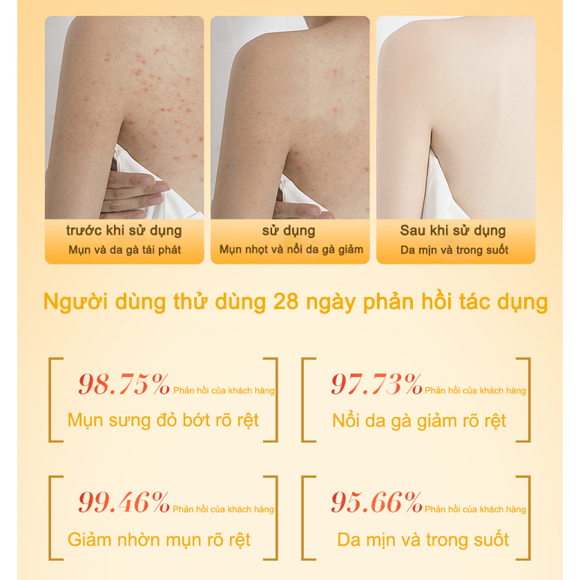 Sữa  tắm trắng da sữa tắm mụn lưng sữa tắm viêm nang lông 400ML chiết xuất 100% suối lưu huỳnh tự nhiên.