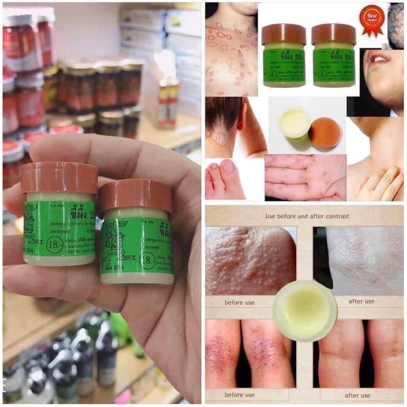 Kem 29A Bôi Da Thái Lan, Kem Bôi Chàm, Ghẻ Ngứa, Hắc Lào Lang Ben Thái Lan