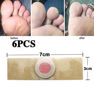 [6 Miếng] Miếng Dán Mụn Cóc, Mụn Cơm, Dán Vết Chai Chân