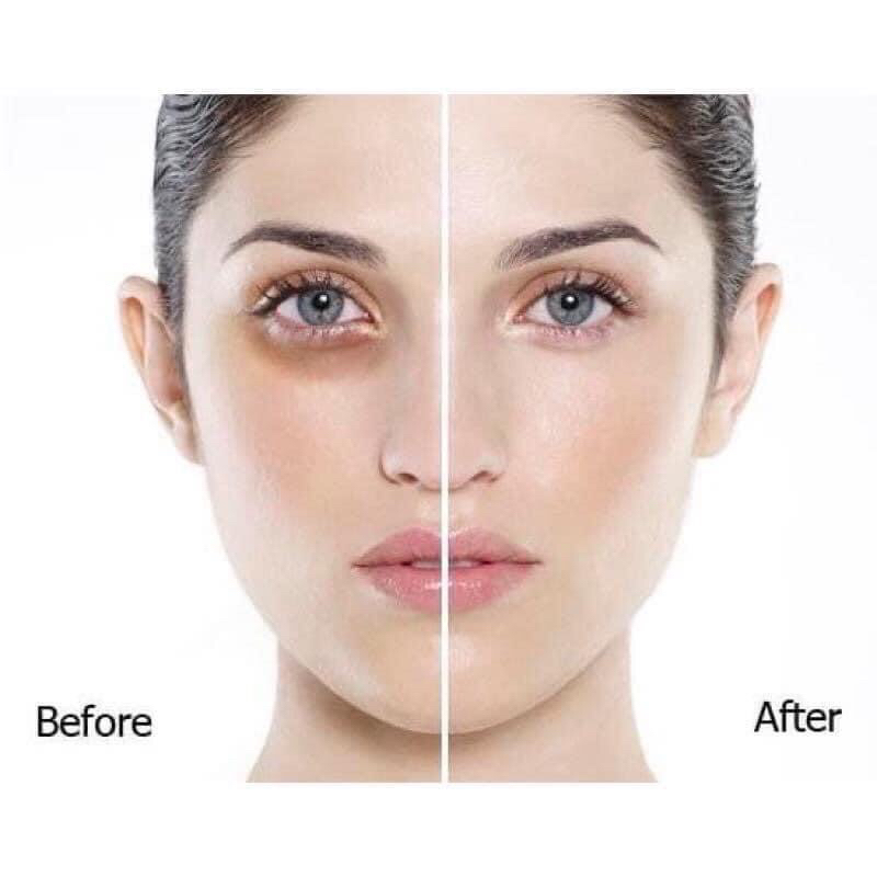 Kem che khuyết điểm Mira Cover Foundation