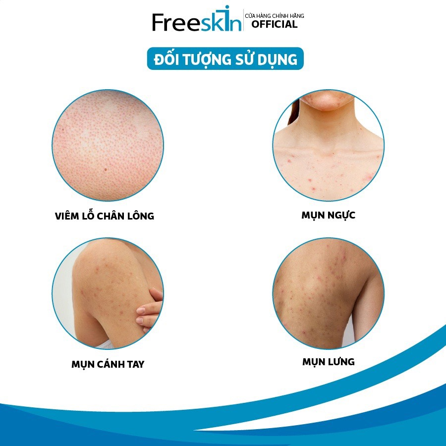 Xịt mụn Freeskin - Xịt mụn lưng, viêm nang lông, dày sừng nang lông, viêm da, sạch mụn, mờ thâm, sáng da 80ml