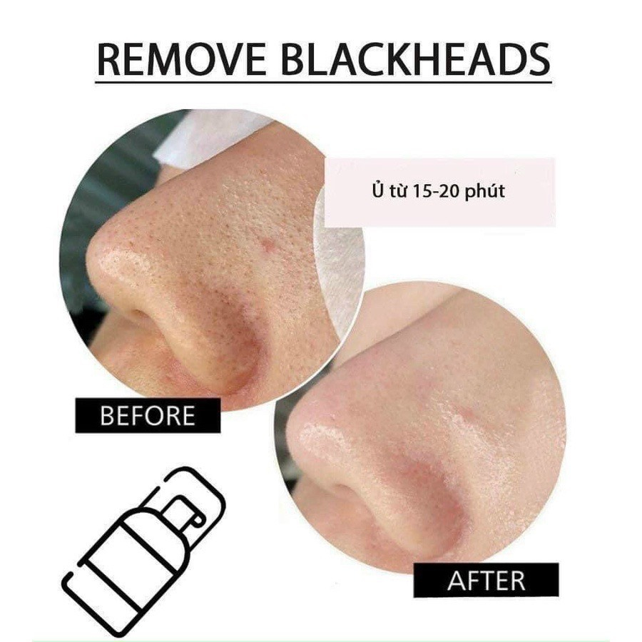 Ủ mụn Remove Blackheads làm sạch sợi bã nhờn, mụn đầu đen, se khít lỗ chân lông 50ml