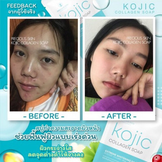 Xà phòng trắng da Kojic Collagen Soap