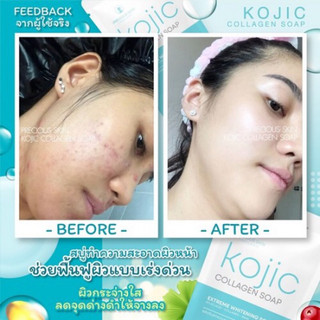 Xà phòng trắng da Kojic Collagen Soap