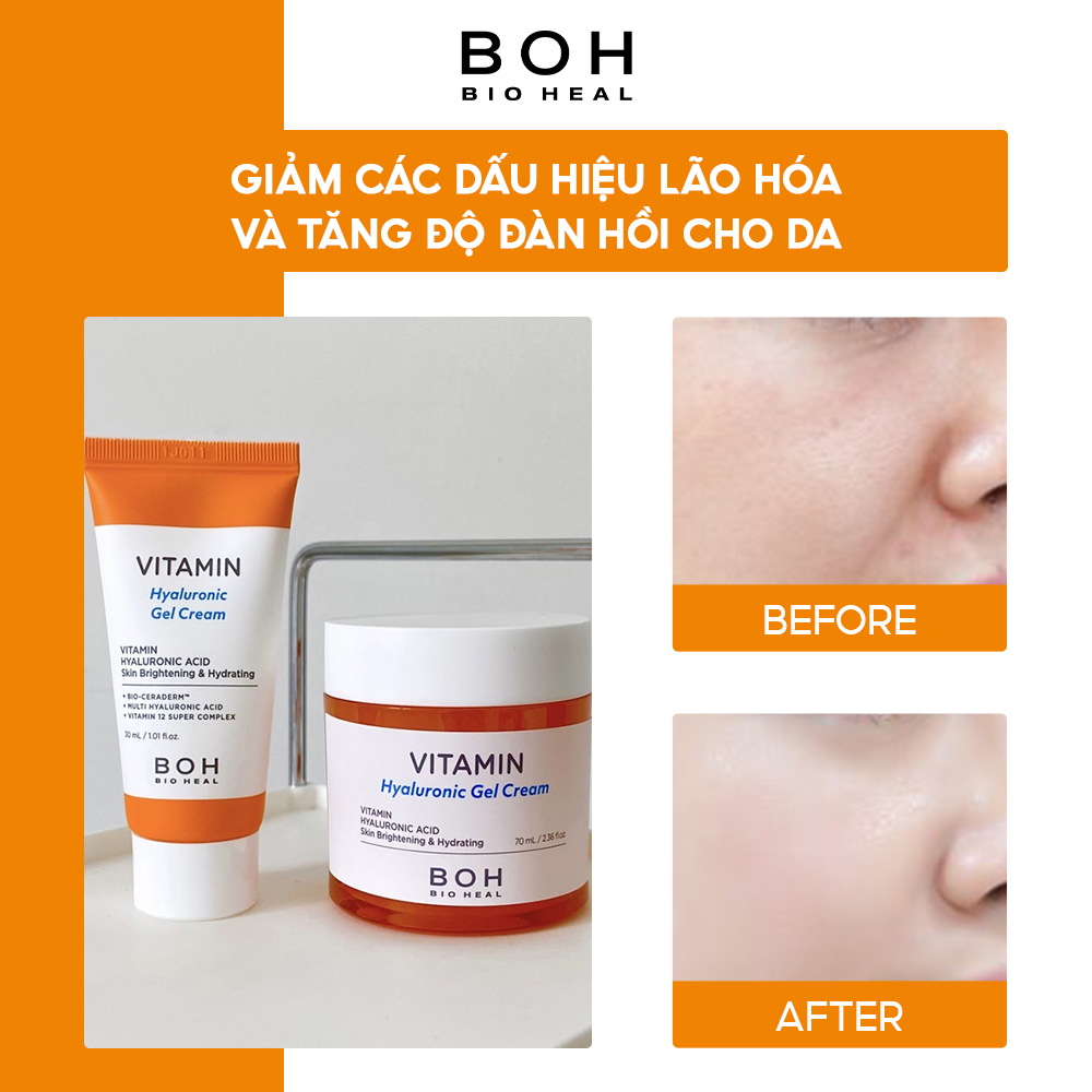 Bộ Đôi Dưỡng Trắng Da BIOHEAL BOH VITAMIN HYALURONIC GEL CREAM SPECIAL SET 70ML (+30ML)