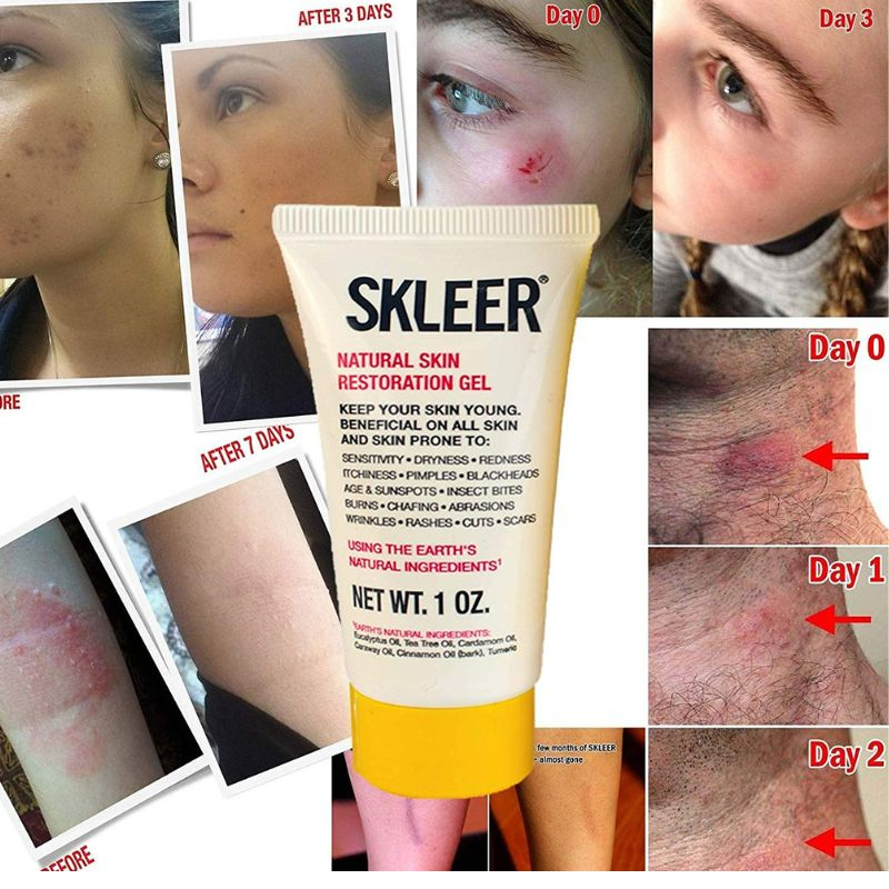 Gel giảm viêm, dưỡng ẩm, phục hồi da SKLEER Natural Skin Restoration