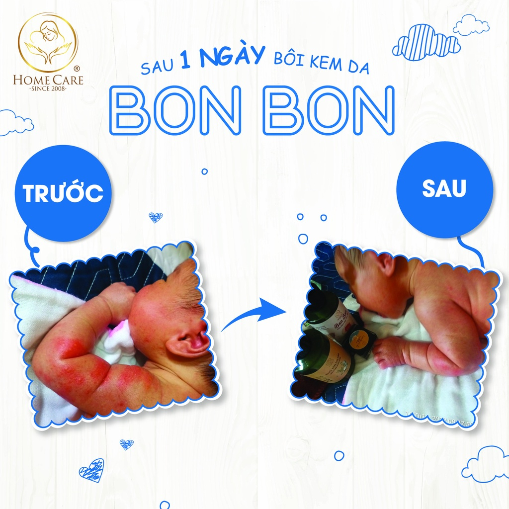 Kem Hăm Cho Bé Ich Nhi  Home Care Thành Phần Thiên Nhiên An Toàn Dịu Nhẹ Cho Da Bé Yêu