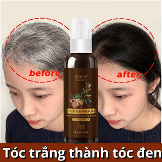 Xịt mọc tóc Tinh chất dưỡng tóc Kích Mọc Tóc 100ml Ngăn ngừa rụng tóc kích mọc tóc cung cấp dưỡng chất Giảm gàu ngứa