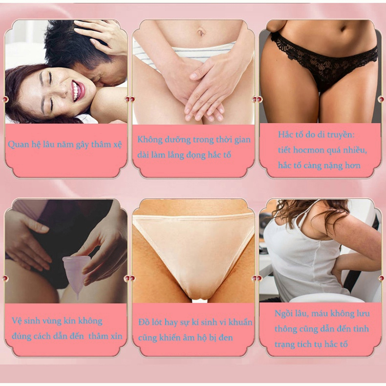 Kem Làm Trắng Da Nách Giảm Thâm Đầu Gối Mông Bikini Khử Mùi Hôi Dưỡng Trắng Da 60g Kem dưỡng 60g