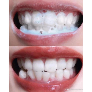 Bột Trắng Răng Thái Lan