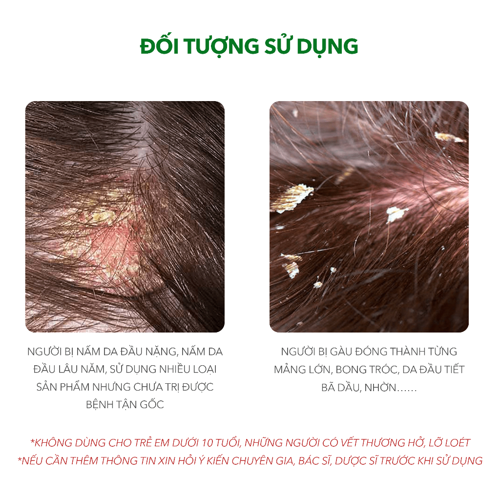 Sản Phẩm Ezema 50 | Thương Hiệu iCare Pharma | Hỗ Trợ Loại Bỏ Nấm Da Đầu Bong Tróc Vảy Trắng | Chiết Xuất Gurjun Ấn Độ