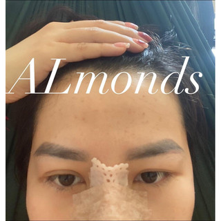 Cao mụn  Acnes Skin Care Almonds