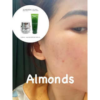 Cao mụn  Acnes Skin Care Almonds