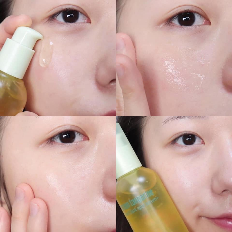 Serum Goodal Green Tangerine C Dark Spot 30ml-  Vị cứu tinh cho làn da thâm nám xỉ