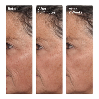 Tinh chất làm mờ nếp nhăn Murad Targeted Wrinkle Corrector 15ml