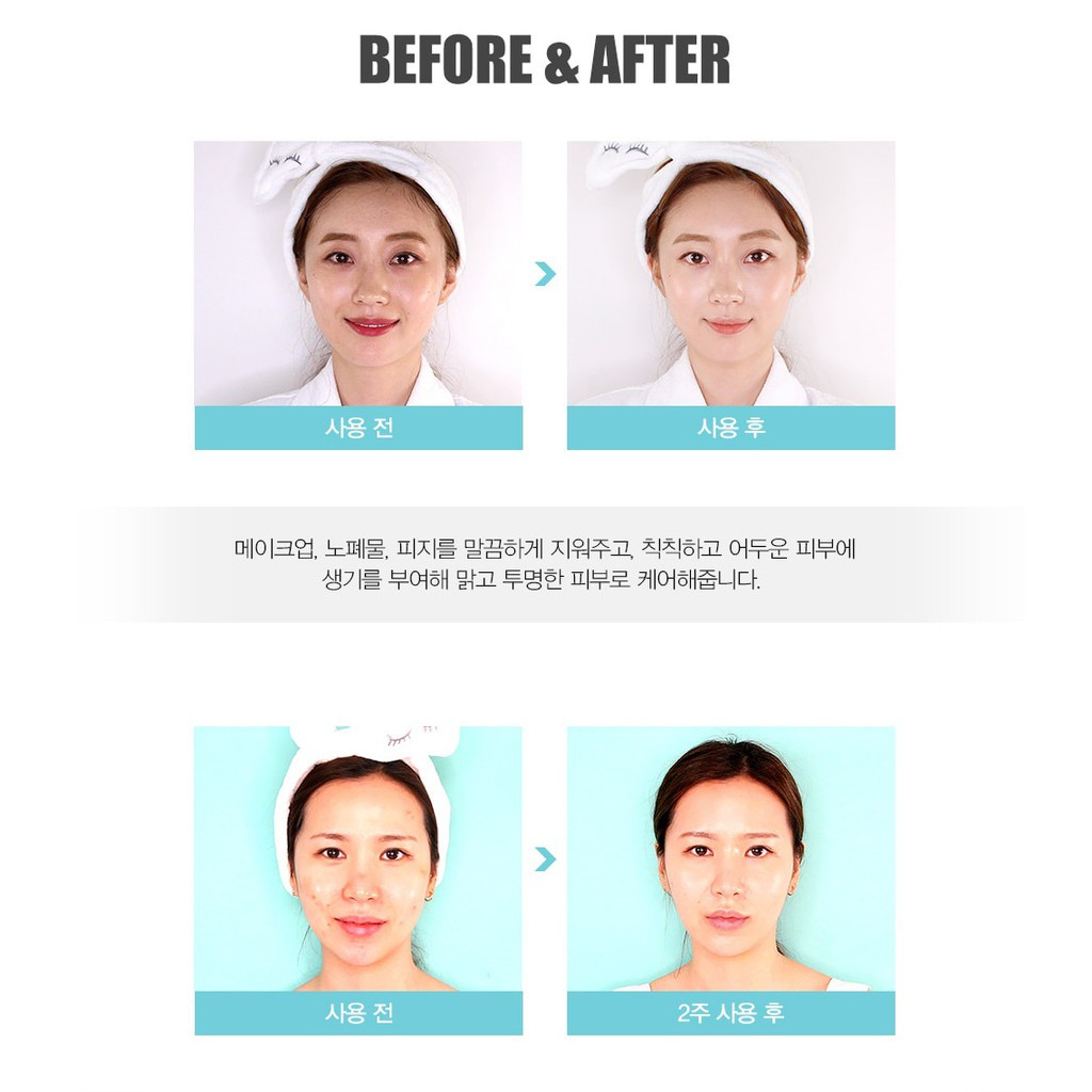 Sữa rửa mặt trắng da mờ thâm Dr Smis Vitamin Capsule Cleasing Foam 300ml