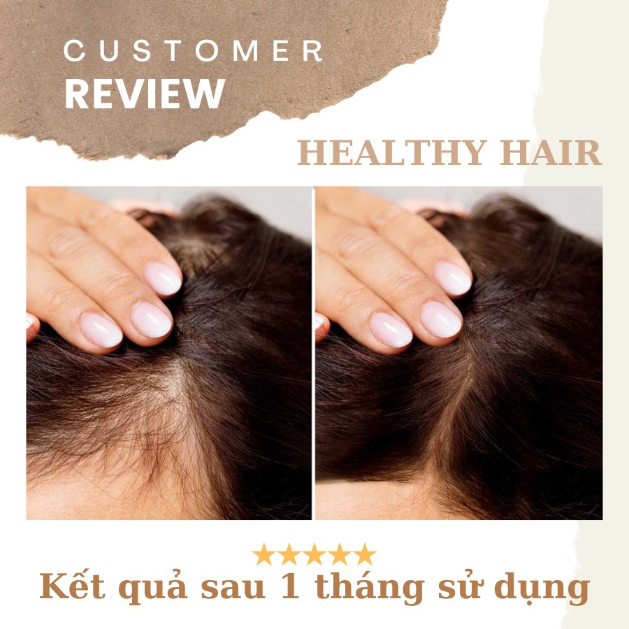 Vitamin B5 Bedipanten 100mg - viên ủ tóc hỗ trợ giảm rụng tóc