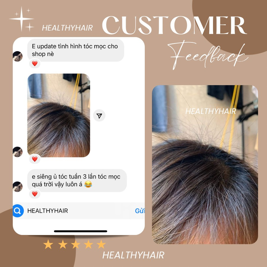 Vitamin B5 Bedipanten 100mg - viên ủ tóc hỗ trợ giảm rụng tóc